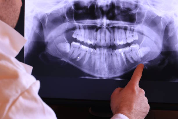 Best Emergency Broken Tooth Repair in New Canaan, CT